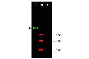 Image no. 1 for anti-GLI Family Zinc Finger 2 (GLI2) (Internal Region) antibody (ABIN401282) (GLI2 anticorps  (Internal Region))