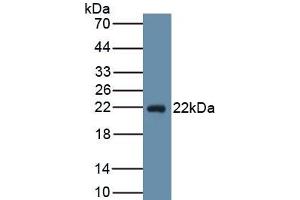 Detection of Recombinant PGD2S, Human using Monoclonal Antibody to Prostaglandin-H2 D-isomerase (PTGDS)