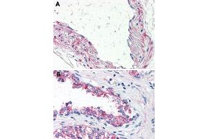 Immunohistochemical staining of formalin-fixed, paraffin-embedded human vessel (A) and human prostate (B) tissue after heat-induced antigen retrieval. (5HT1B Receptor anticorps  (Internal Region))