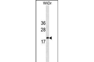 IFNA5 Antibody (C-term) (ABIN1536762 and ABIN2849940) western blot analysis in WiDr cell line lysates (35 μg/lane). (IFNA5 anticorps  (C-Term))