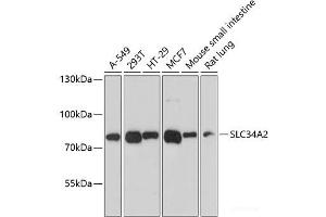 Western blot analysis of extracts of various cell lines using SLC34A2 Polyclonal Antibody at dilution of 1:3000. (SLC34A2 anticorps)