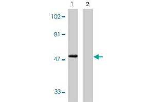 Western blot analysis using CX3CR1 polyclonal antibody at 1 ug/mL on human spleen lysate in the absence (lane 1) and presence (lane 2) of specific blocking peptide. (CX3CR1 anticorps  (AA 2-21))