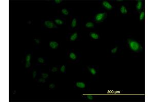 Immunofluorescence of monoclonal antibody to EP300 on HeLa cell. (p300 anticorps  (AA 731-830))