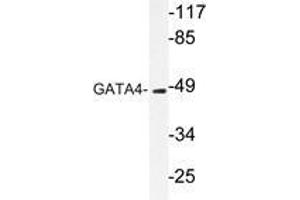 Western blot analysis of GATA4 antibody in extracts from COLO205 cells. (GATA4 anticorps)