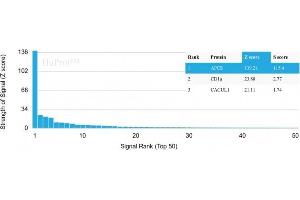 Analysis of Protein Array containing more than 19,000 full-length human proteins using Serum Amyloid P Mouse Monoclonal Antibody (APCS/3240).
