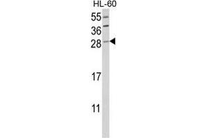 Western blot analysis of GZMB Antibody (C-term) in HL-60 cell line lysates (35 µg/lane).