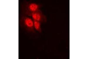 Immunofluorescent analysis of MKK1 (pT292) staining in HeLa cells. (MEK1 anticorps  (pSer292))