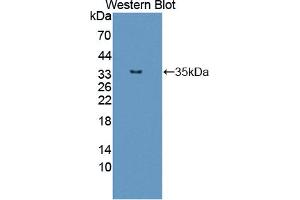 Western blot analysis of the recombinant protein. (TPM3 anticorps  (AA 6-248))