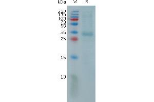 Human P Protein, His Tag on SDS-PAGE under reducing condition.