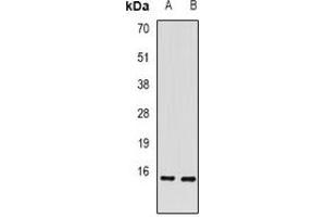 Western blot analysis of RBP2 expression in mouse intestine (A), rat liver (B) whole cell lysates. (RBP2 anticorps)