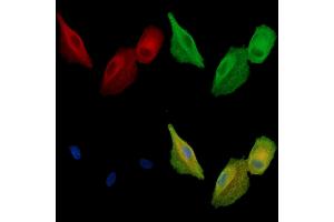ABIN7095037 and ABIN7099093 staining  cells by IF/ICC.