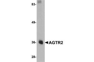 Western blot analysis of AGTR2 in mouse liver tissue lysate with AP30027PU-N AGTR2 antibody at 0.