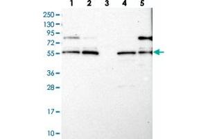Western blot analysis of Lane 1: RT-4, Lane 2: U-251 MG, Lane 3: Human Plasma, Lane 4: Liver, Lane 5: Tonsil with LRCH4 polyclonal antibody . (LRCH4 anticorps)