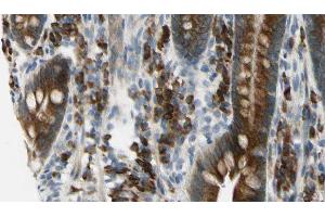 ABIN6275968 at 1/100 staining Mouse intestine tissue by IHC-P. (Adenosine A2a Receptor anticorps  (Internal Region))