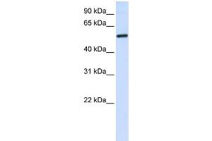 WB Suggested Anti-ALAS2 Antibody Titration:  0. (ALAS2 anticorps  (C-Term))