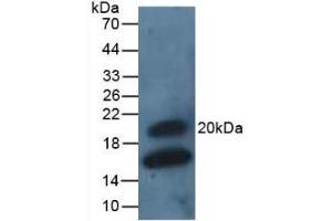 Detection of GREM1 in Rat Intestine Tissue using Polyclonal Antibody to Gremlin 1 (GREM1) (GREM1 anticorps  (AA 26-184))