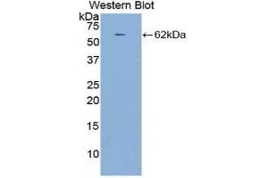 Western Blotting (WB) image for anti-Angiotensin I Converting Enzyme (Peptidyl-Dipeptidase A) 1 (ACE) (AA 814-1071) antibody (ABIN1857858) (Angiotensin I Converting Enzyme 1 anticorps  (AA 814-1071))