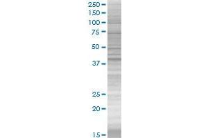 PARK2 transfected lysate.