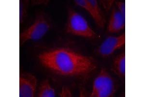 Immunofluorescence staining of methanol-fixed HeLa cells using PLC-γ2 (Ab-1217) Antibody (E021524, Red)