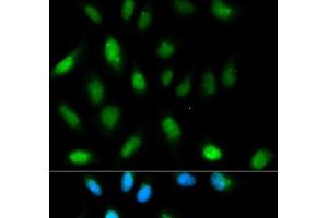 Immunofluorescence analysis of HeLa cells using CBX5 Polyclonal Antibody (CBX5 anticorps)