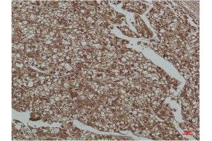 Immunohistochemistry (IHC) analysis of paraffin-embedded Human Liver Tissue using Smad3 Mouse Monoclonal Antibody diluted at 1:200. (SMAD3 anticorps)