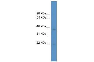 WB Suggested Anti-RHOXF1 Antibody Titration:  0.