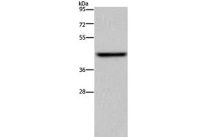 Western Blot analysis of Mouse liver tissue using ENTPD5 Polyclonal Antibody at dilution of 1:500 (ENTPD5 anticorps)