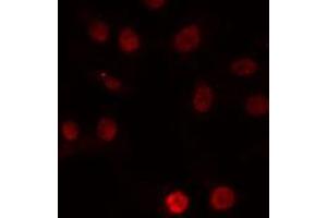 ABIN6274222 staining Hela cells by IF/ICC. (ERCC5 anticorps  (N-Term))