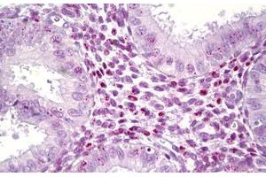 Anti-HMGB1 antibody IHC staining of human, uterus. (HMGB1 anticorps  (AA 131-180))