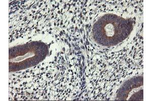 Immunohistochemical staining of paraffin-embedded Human endometrium tissue using anti-ALG2 mouse monoclonal antibody. (ALG2 anticorps)