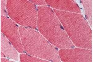 anti-Tripartite Motif Containing 5 (TRIM5) antibody