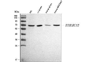 Western blot analysis of SIGLEC12 using anti-SIGLEC12 antibody (ABIN7601259).