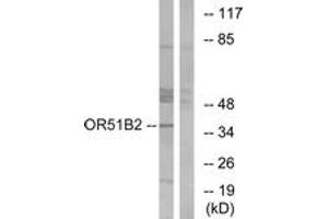Western blot analysis of extracts from HT-29 cells, using OR51B2 Antibody. (OR51B2 anticorps  (AA 196-245))