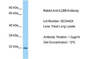 Host: Rabbit Target Name: IL28B Sample Type: Fetal Lung Antibody Dilution: 1. (IL28B anticorps  (C-Term))