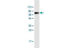 Western Blot detection against Immunogen (67. (TYW1 anticorps  (AA 1-384))