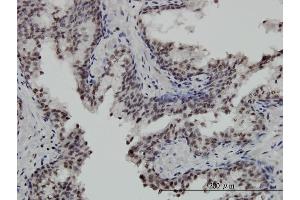 Immunoperoxidase of monoclonal antibody to STK32C on formalin-fixed paraffin-embedded human prostate. (STK32C anticorps  (AA 1-369))