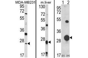 (LEFT) Western blot analysis of GSTM1 Antibody (C-term) in MDA-MB231 cell line lysates (35 µg/lane). (GSTM1 anticorps  (C-Term))