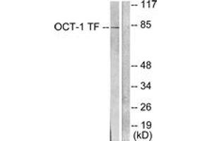 Western blot analysis of extracts from HeLa cells, using OCT1 Antibody. (POU2F1 anticorps  (AA 41-90))