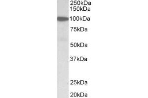 Western Blotting (WB) image for anti-Gelsolin (GSN) (AA 40-51) antibody (ABIN1101907) (Gelsolin anticorps  (AA 40-51))