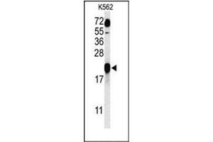Western blot analysis of GAGE7 Antibody (C-term) in K562 cell line lysates (35ug/lane). (G Antigen 7 anticorps  (C-Term))
