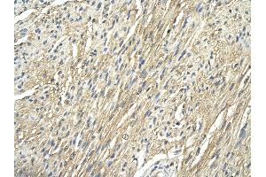 Rabbit Anti-RPS29 antibody        Paraffin Embedded Tissue:  Human Heart   Cellular Data:  cardiac cells  Antibody Concentration:   4.