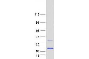 Validation with Western Blot