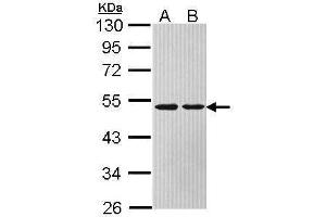 WB Image Sample (30 ug of whole cell lysate) A: Hela B: Hep G2 , 10% SDS PAGE antibody diluted at 1:1000 (ASL anticorps)