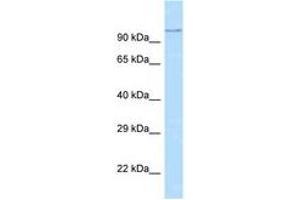 Image no. 1 for anti-ADAM Metallopeptidase Domain 29 (ADAM29) (AA 101-150) antibody (ABIN6748266) (ADAM29 anticorps  (AA 101-150))