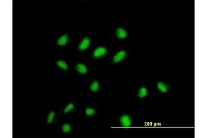 Immunofluorescence of monoclonal antibody to CDYL on HeLa cell.