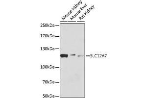 Western blot analysis of extracts of various cell lines, using SLC12 antibody (ABIN6131138, ABIN6147845, ABIN6147846 and ABIN6215907) at 1:1000 dilution.