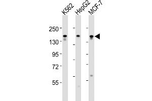 All lanes : Anti-RGEF1 Antibody (Center) at 1:1000-1:2000 dilution Lane 1: K562 whole cell lysates Lane 2: HepG2 whole cell lysates Lane 3: MCF-7 whole cell lysates Lysates/proteins at 20 μg per lane. (GRF2 anticorps  (AA 536-569))