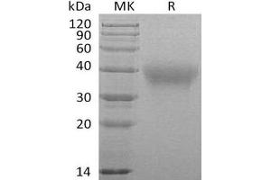 Western Blotting (WB) image for Frizzled Family Receptor 1 (Fzd1) protein (Fc Tag) (ABIN7320532)