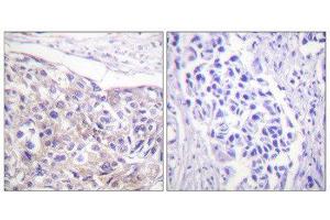 Immunohistochemistry (IHC) image for anti-Ribosomal Protein S6 Kinase, 90kDa, Polypeptide 3 (RPS6KA3) (pThr573) antibody (ABIN1847290) (RPS6KA3 anticorps  (pThr573))