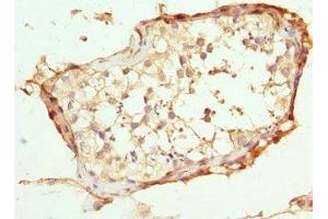 Immunohistochemistry of paraffin-embedded human testis tissue using ABIN7144903 at dilution of 1:100 (ABCC11 anticorps  (AA 1-170))